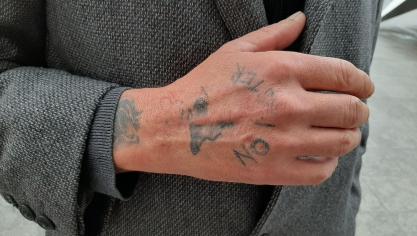 Isbergues: un tatouage a failli lui faire perdre sa main